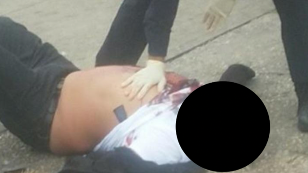 The victim of a Bayonne shooting yesterday. His face has been censored out of respect for his family. Facebook photo. 