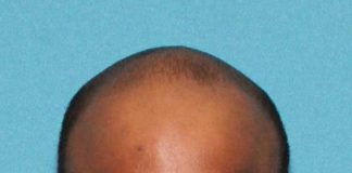 Hoboken man busted with heroin & cocaine following month-long investigation